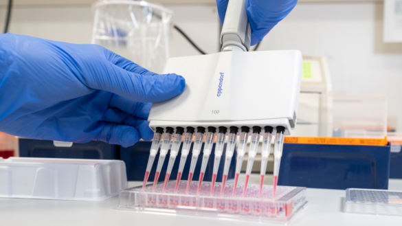 Nu utökar Sverige provtagning för coronavirus covid-19